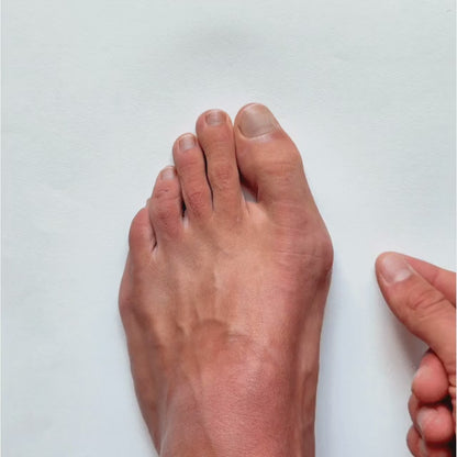 Hallux Valgus Tapes